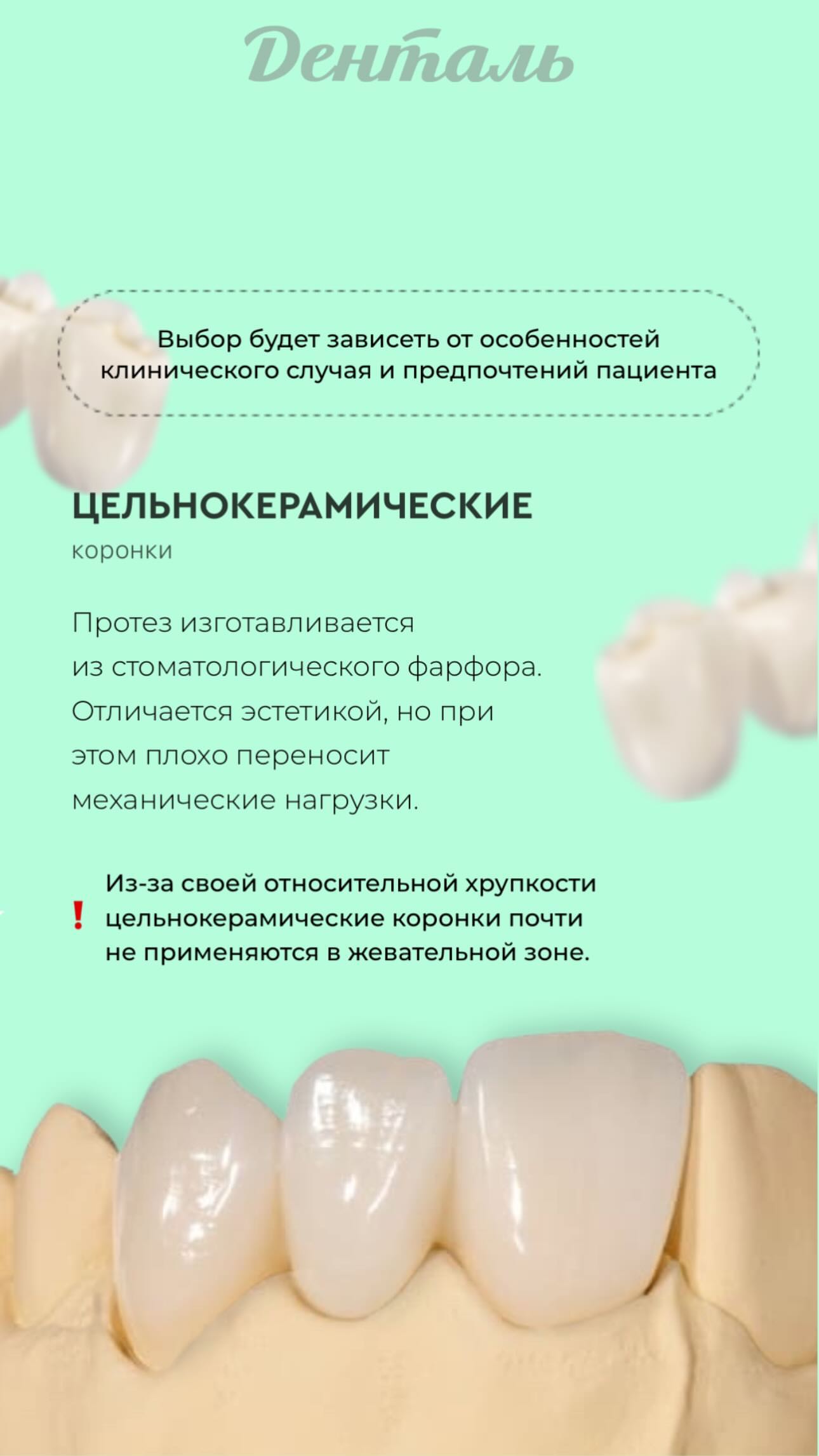 Цельнокерамические коронки