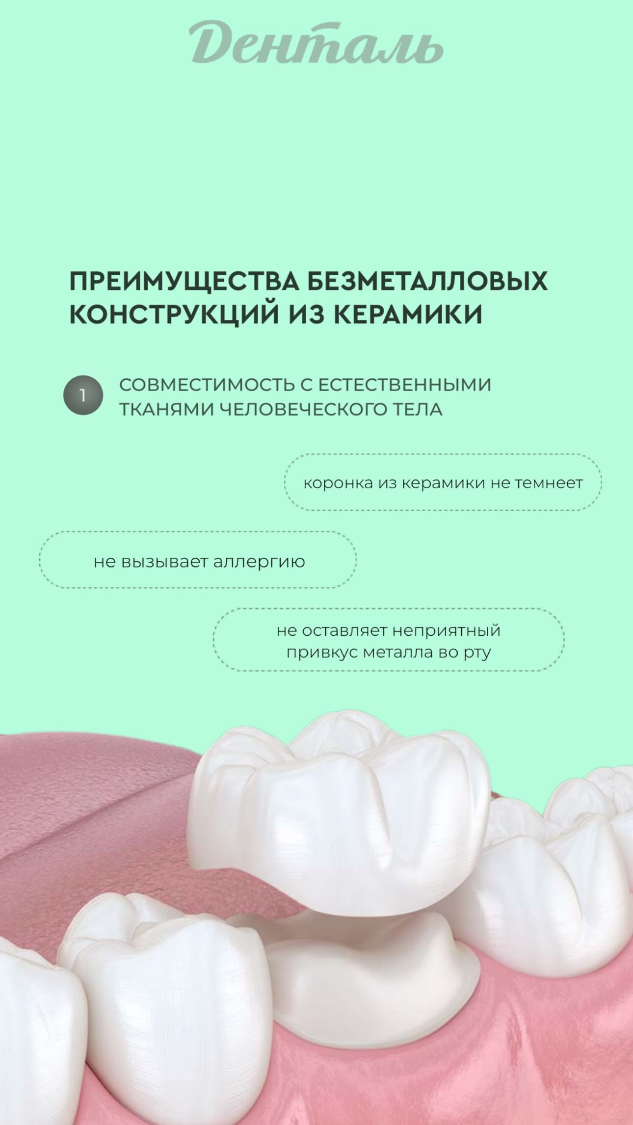 Преимущества керамических коронок