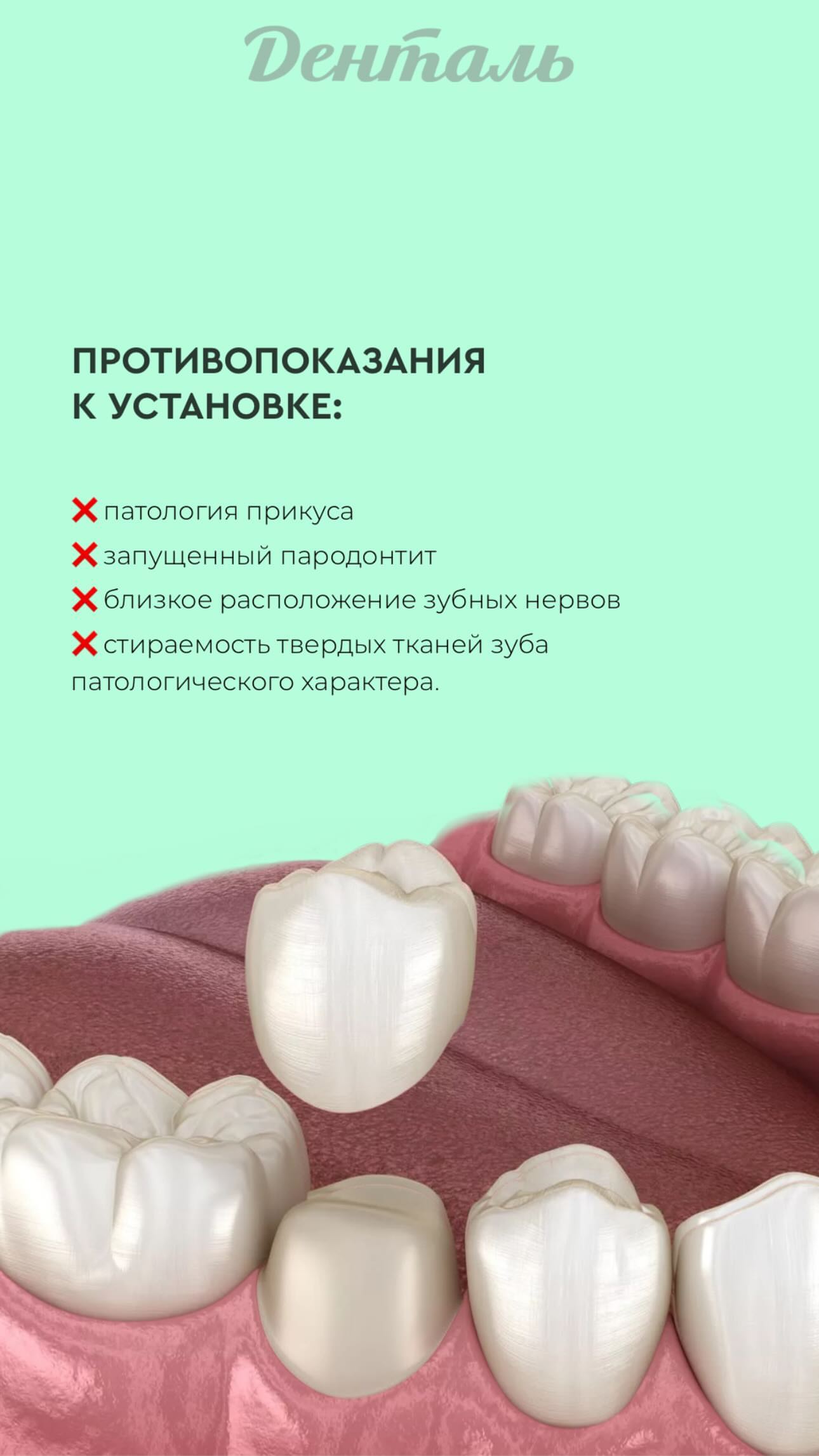 Работа стоматология коронки