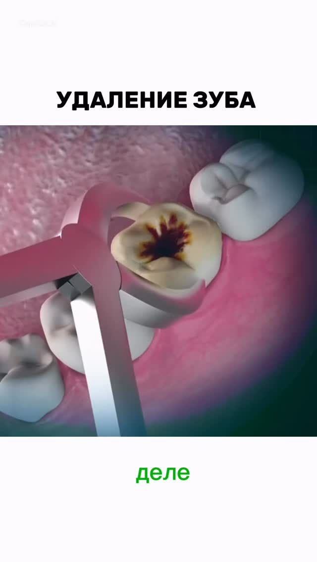 Стоматология видео