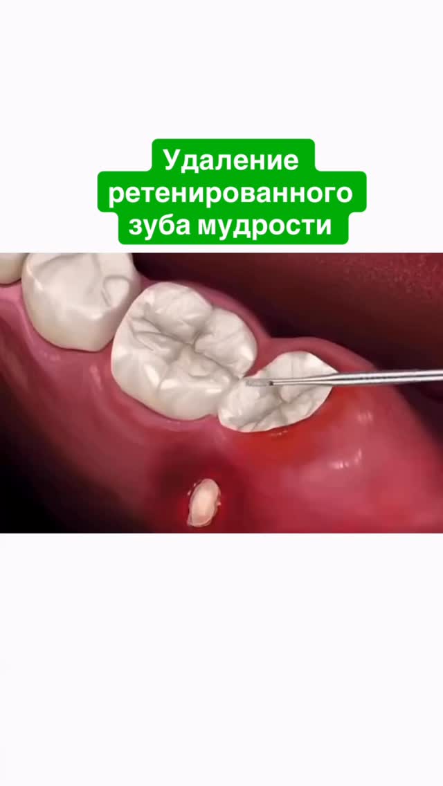 Instagram dentaly.kg